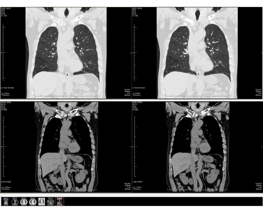 DWIBS（ドゥイブス）検査とは？