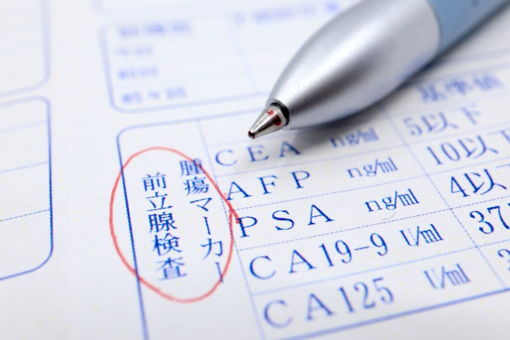 PSA検査の基準値と数値が高い・低いときに推奨される行動