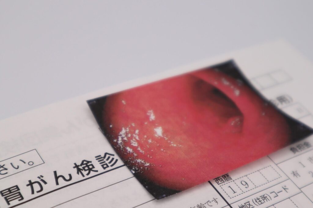 バリウム検査と胃カメラ検査どっちが楽に受けられる？