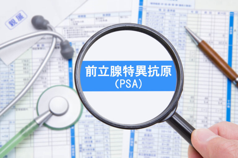 PSA検査とは？検査方法やメリット・デメリット、数値の基準など解説の画像