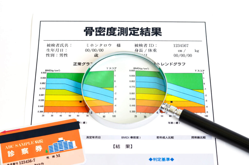 骨密度検査の数値の見方