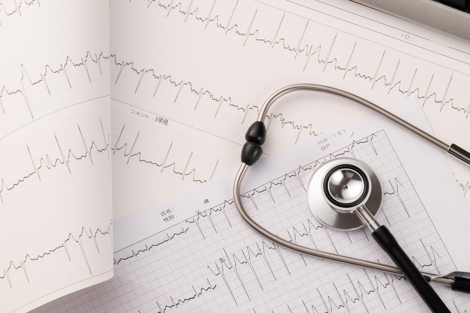 心臓ドックとは？検査でわかることや費用、受けた方がいい人の特徴など解説