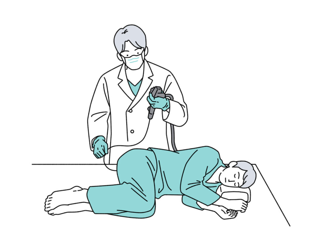 大腸カメラはどのくらい痛い？