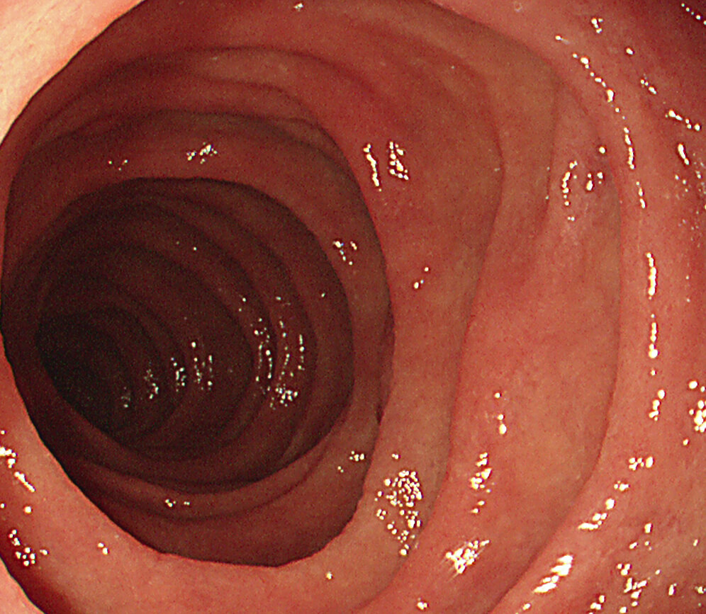 食道がんを早期発見するための検査方法
