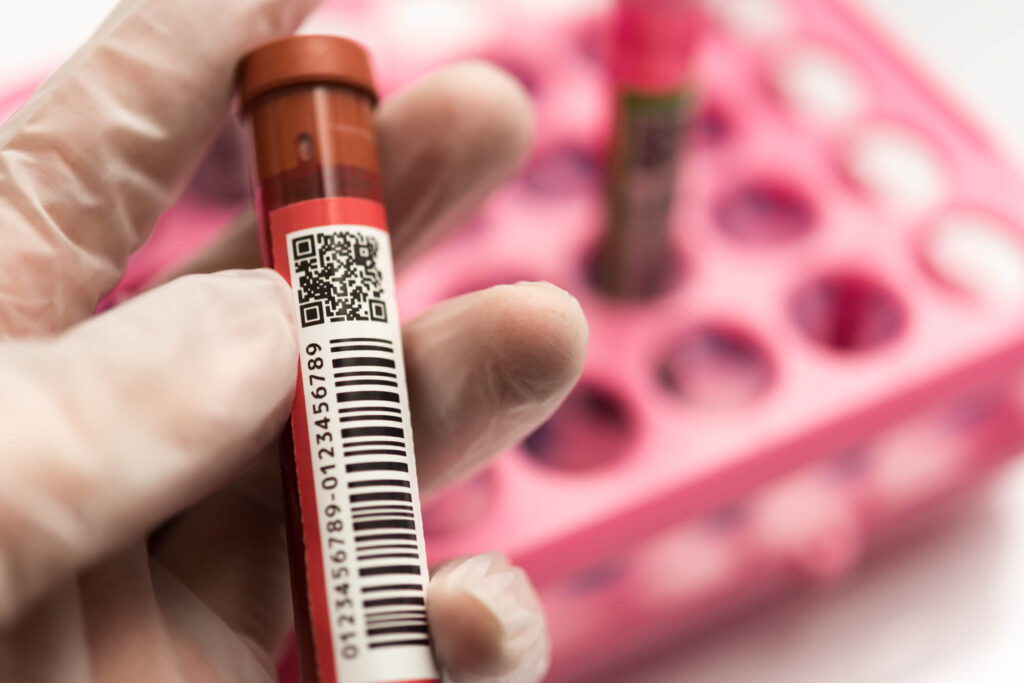 バリウム検査と胃カメラ検査のどっちも嫌な場合の検査法