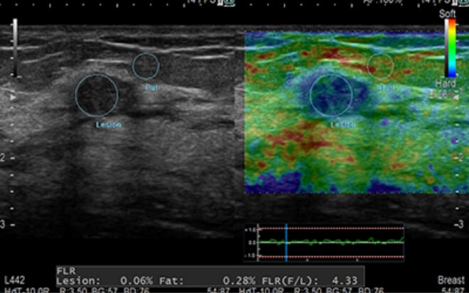 スーパードック
