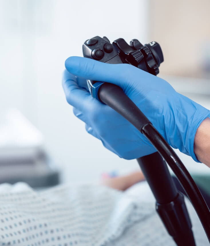 下部内視鏡検査