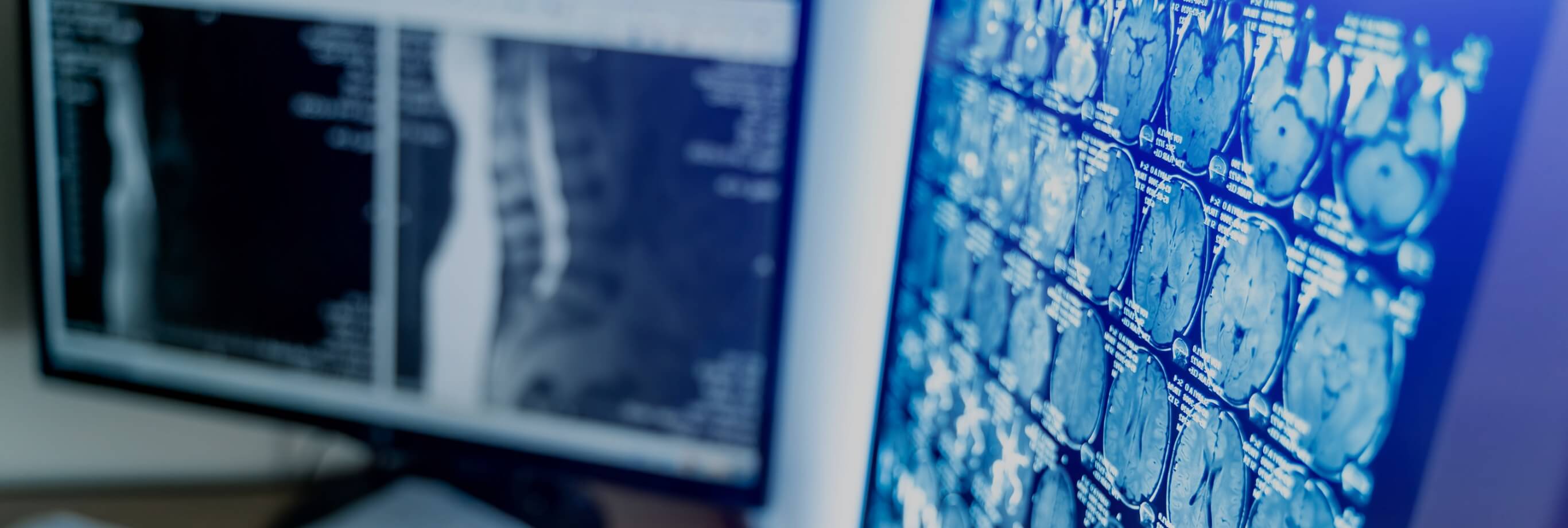 検査機器についてのイメージ