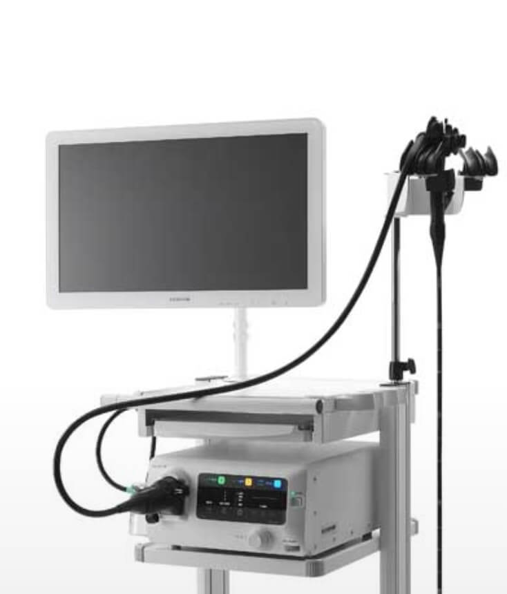 上部内視鏡検査