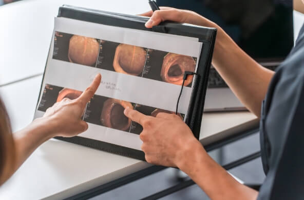 胃カメラでわかること