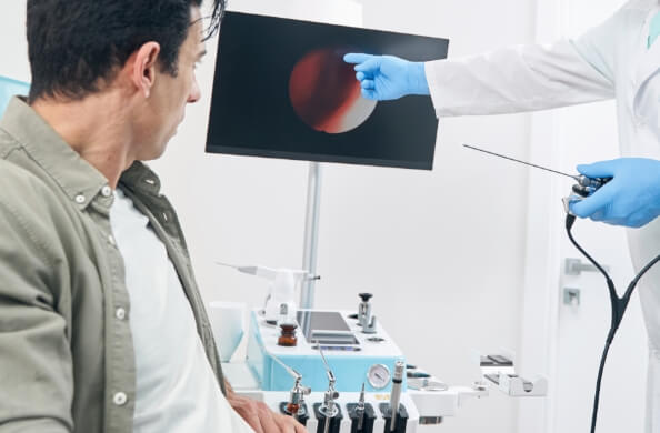 胃カメラでわかること