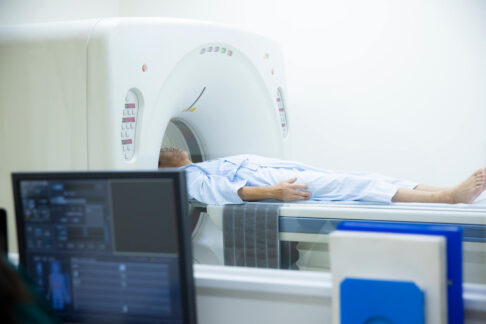 PET-CTとは？費用や検査でわかることなど徹底解説