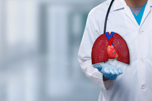 全身がん検査をするには？費用や検査方法を解説