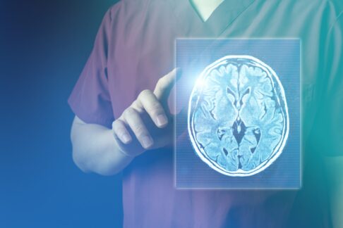 脳ドックでわかることは？受けるべき人の特徴や費用なども解説