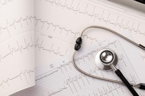 心臓ドックとは？検査でわかることや費用、受けた方がいい人の特徴など解説