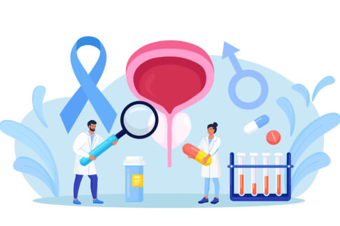 PSMA-PET検査とは？前立腺がんを見つけられるって本当？費用や保険適用についても解説