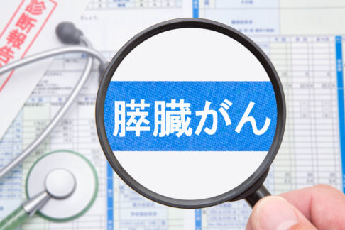 膵臓がん（すい臓がん）の初期症状チェック｜発覚のきっかけ・早期発見に必要な検査を解説のイメージ