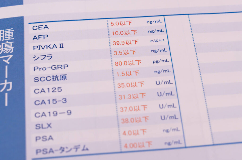 膵臓がんを発覚する4つのきっかけ
