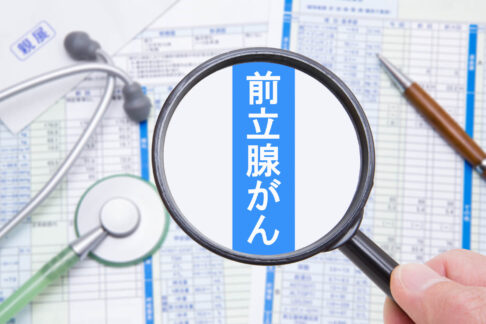 前立腺がん検査の種類と費用など分かりやすく解説